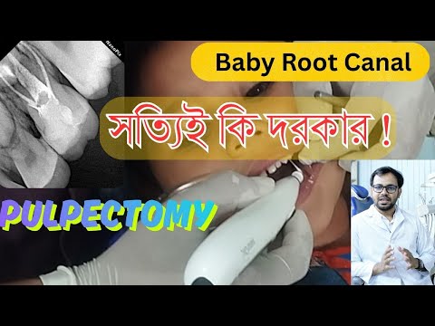শিশুর দাঁতে রুট ক্যানাল কেন প্রয়োজন? video thumbnail